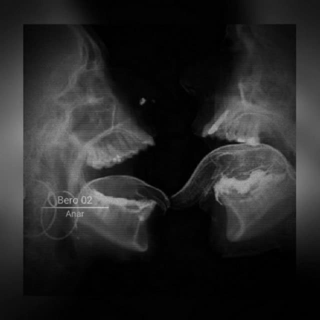 Anar & Polaris - BERO 02 - Ultra Slowed